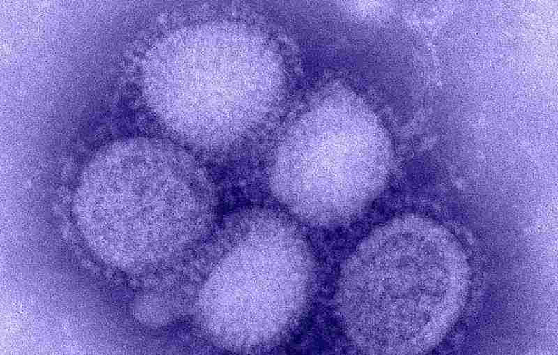 H1N1 influenza virus